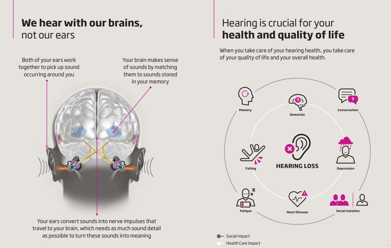 Oticon More We hear with our Brain